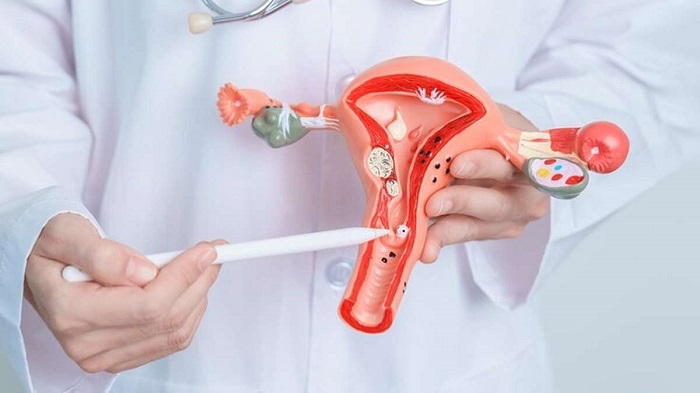 بهترین قرص برای تنبلی تخمدان چیست؟